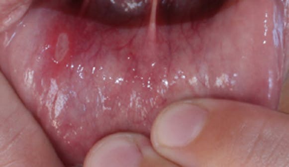 After_w300__52855d8862f45fa0402496eb89ca12c8