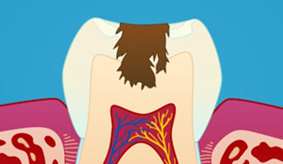 Hull_i_tennene_w300__57505fdae2ad8cc796526ac3cc0e3d8f