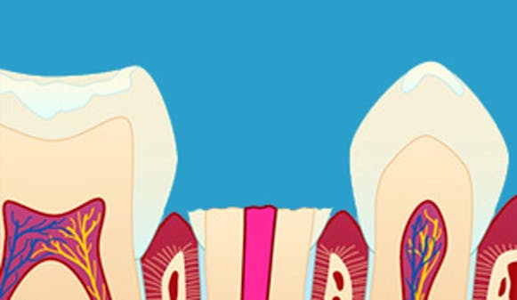 Stift_krone_w300-1__400207c605207f149d191cc94197d0ed