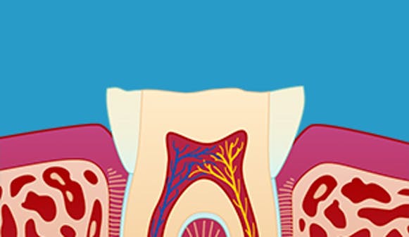 Tanngnissing_thumb_w300__b9b9e5bc881936b1dac527fdeddbd5f5